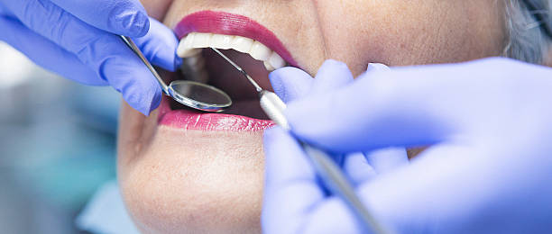 Best Urgent Tooth Repair  in Glenmont, MD